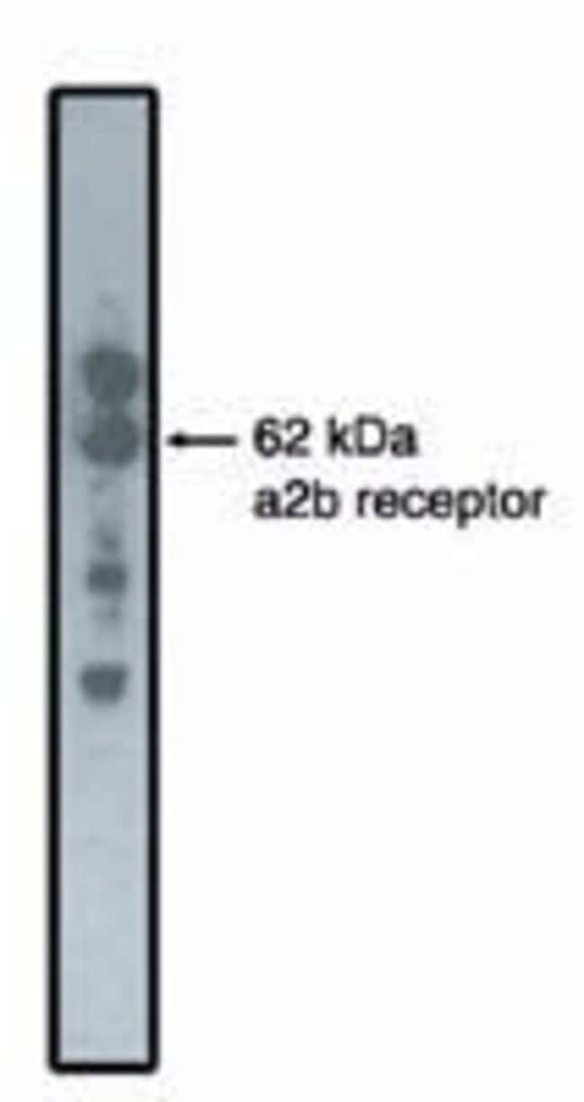 ALPHA-2B ADRENERGIC RECEPTOR