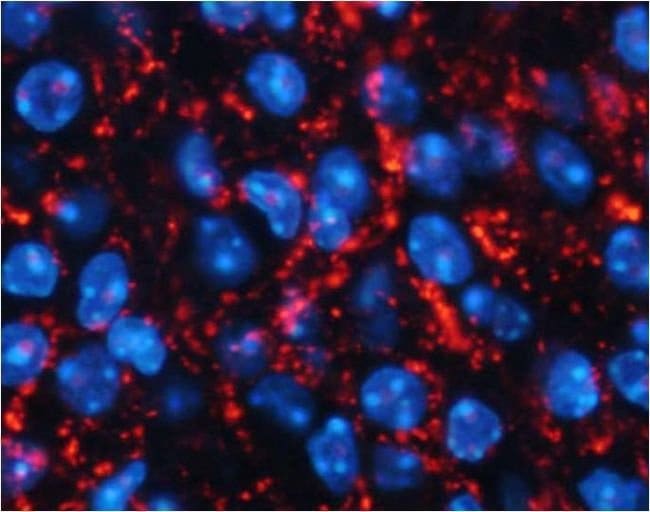 Agouti Related Protein Ab, 50µl,