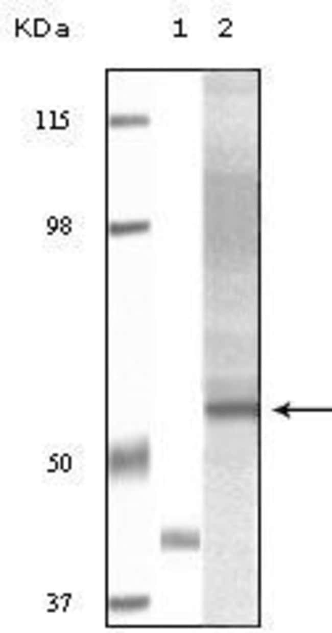 Akt3 Monoclonal Antibody 100 µl µL