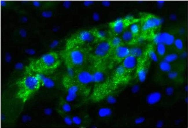 Alpha Fetoprotein Monoclonal Antib. 100