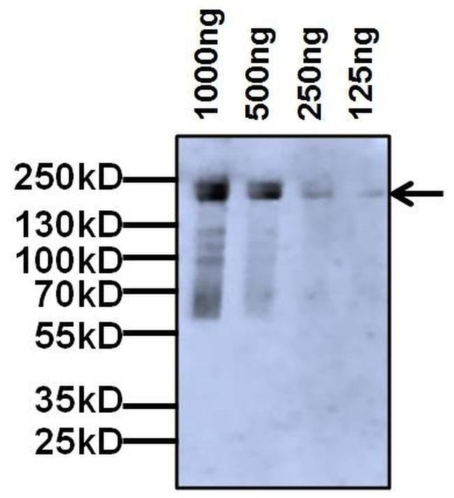 Alpha2-Macroglobulin Monoclonal Antib. 1