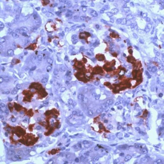 500uL Polyclonal antibody, amylin peptid