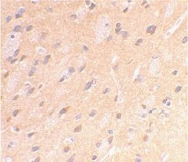 AMYLOID PRECURSOR PROTEIN