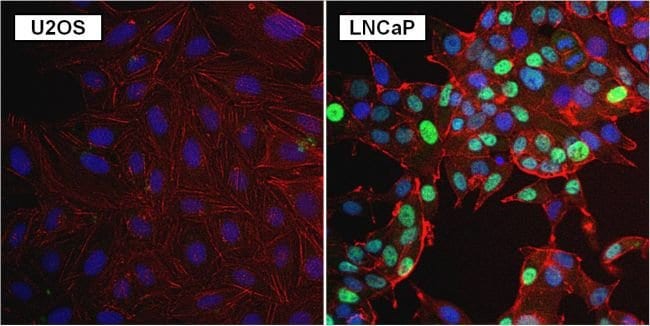 Androgen Receptor (AR 441) Mouse Monoclo