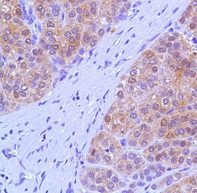 500uL Polyclonal antibody, arginase-1, h