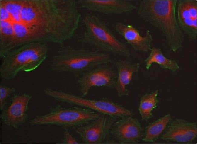 50UG BETA TUBULIN LOAD. CTRL MONOCL. AB,