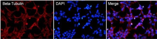 BETA-TUBULIN LOADING CONTROL MONOCLONAL