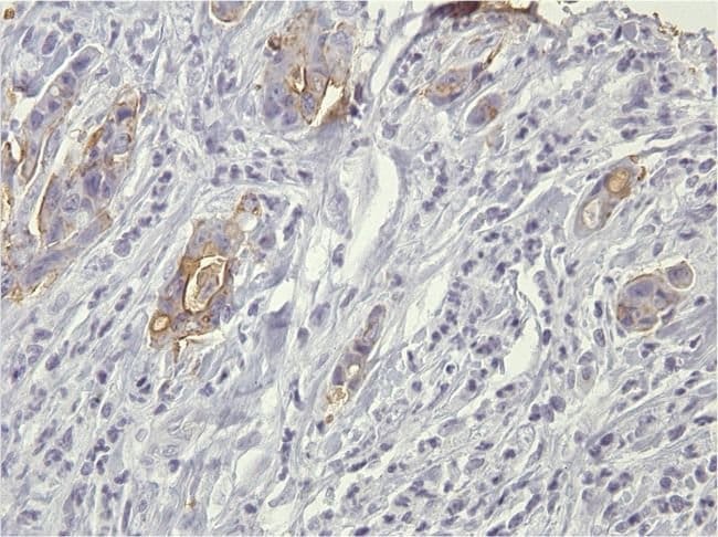 1 ML Blood Group A Antigen Mouse monoclo