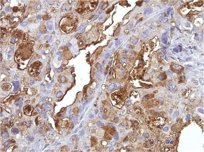 1 ML Blood Group B Antigen Mouse monoclo
