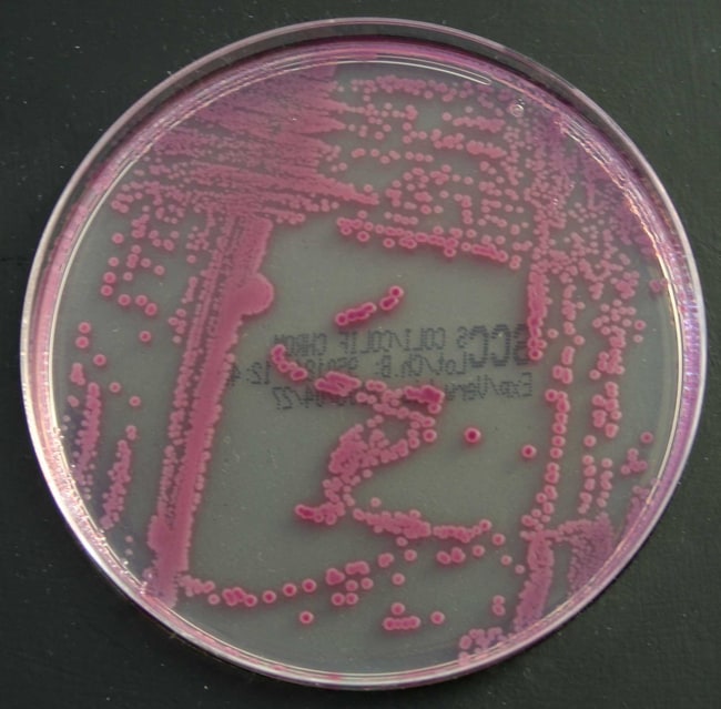 Brilliance E. coli / Coliform Selective