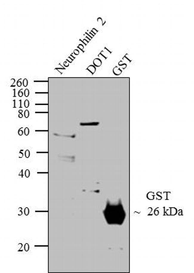 Anti-GST Polyclonal Antibody 1 EA = 100U
