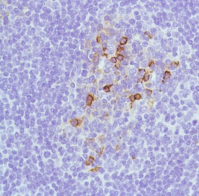 Anti-CD138