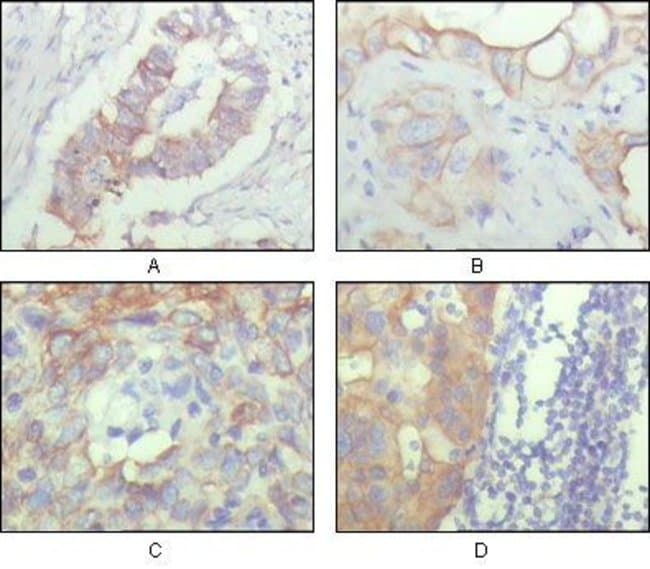 ALCAM Monoclonal Antibody 100 µl µL