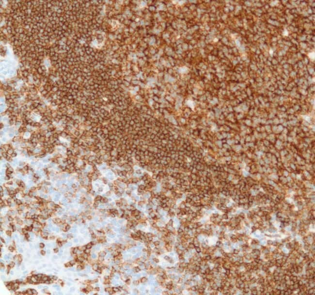 Anti-CD19