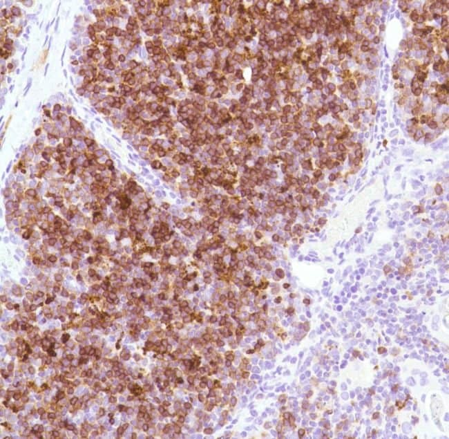 Anti-CD1a