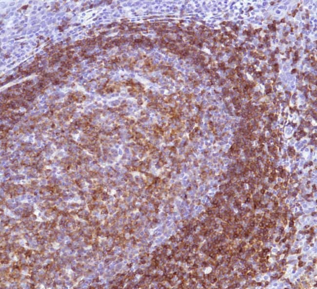 500uL Polyclonal antibody, CD22, host ra