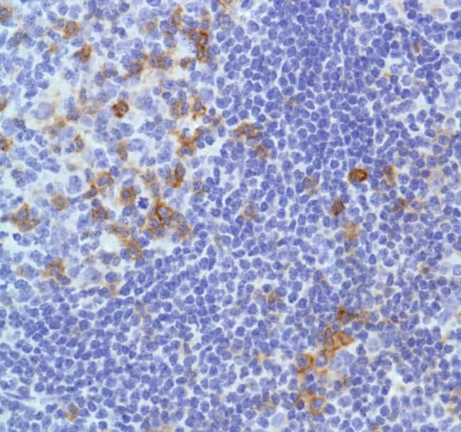 Anti-CD278/ICOS