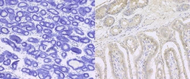 Anti-Integrin beta 1