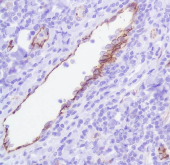 ANTI-CD31