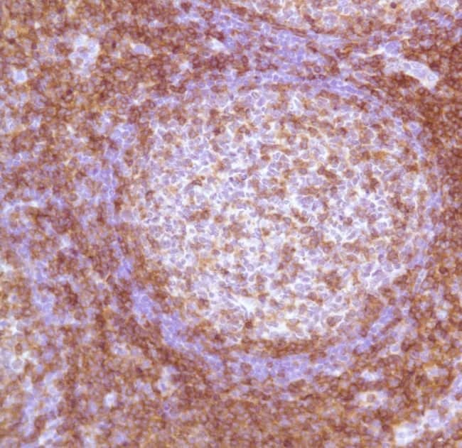 Anti-CD4