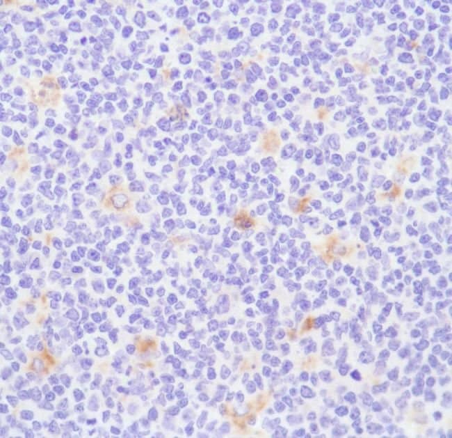 500uL Polyclonal antibody, CD68, host ra