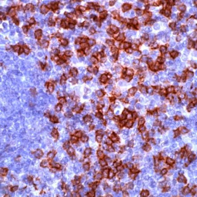 1 ML CD8 Rabbit polyclonal antibody IgG,