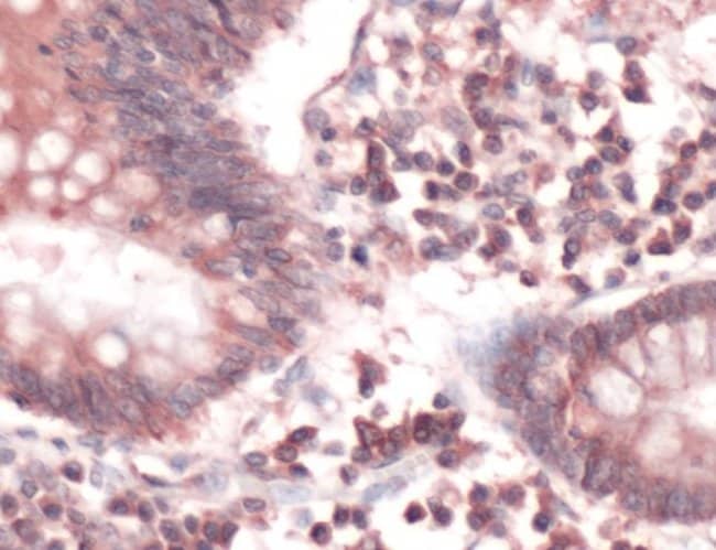 500uL Polyclonal antibody, CD95/fas, hos