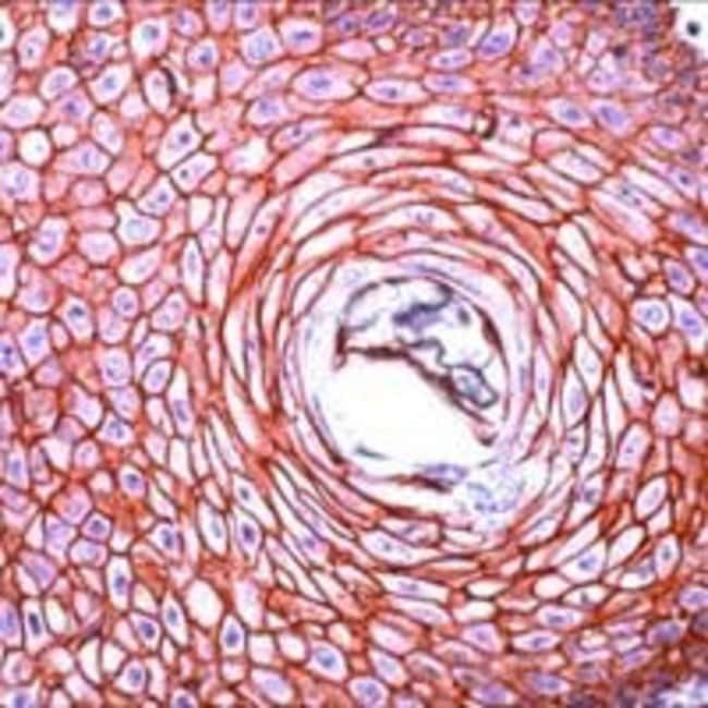1 ML pan Cadherin Rabbit polyclonal anti