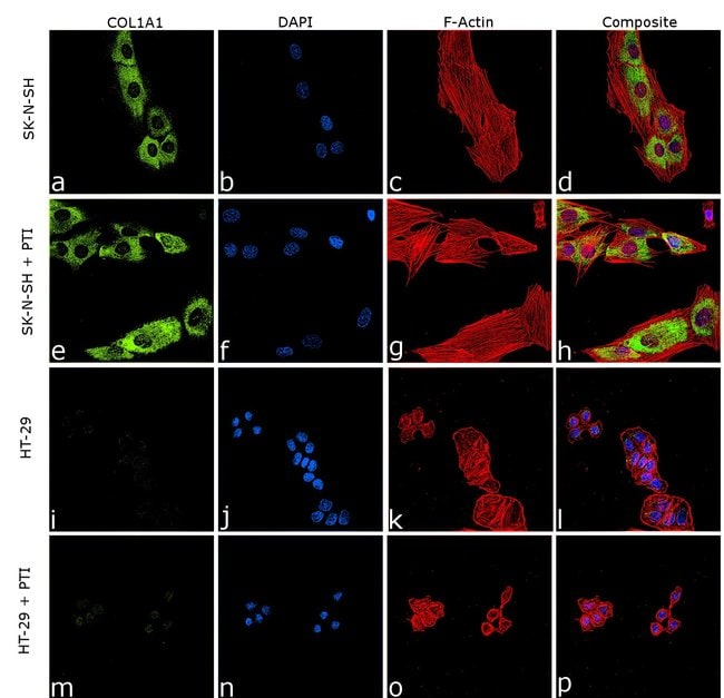 ANTI-COL1A1