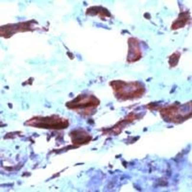 1 ML COX2 Rabbit polyclonal antibody IgG