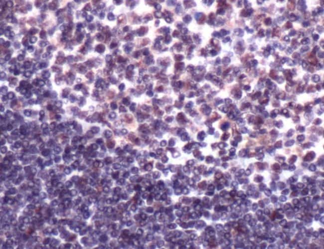 500uL Polyclonal antibody, creB-binding