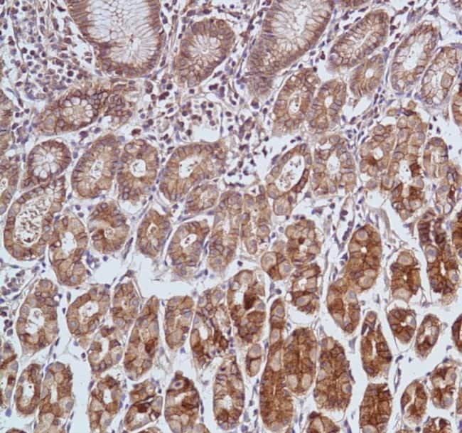 Anti-Carbonic Anhydrase 9