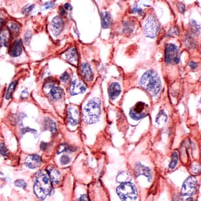 500uL Polyclonal antibody, catenin delta