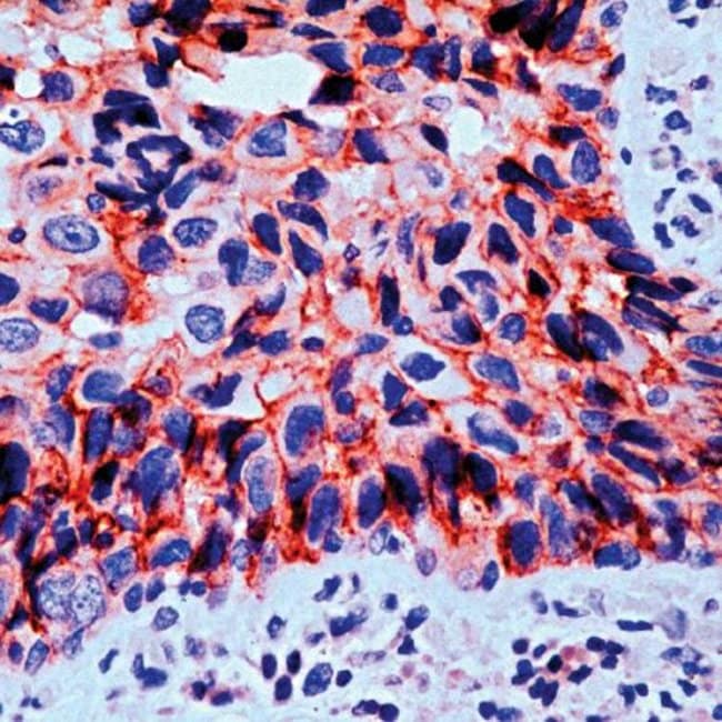 500uL Polyclonal antibody, catenin-gamma