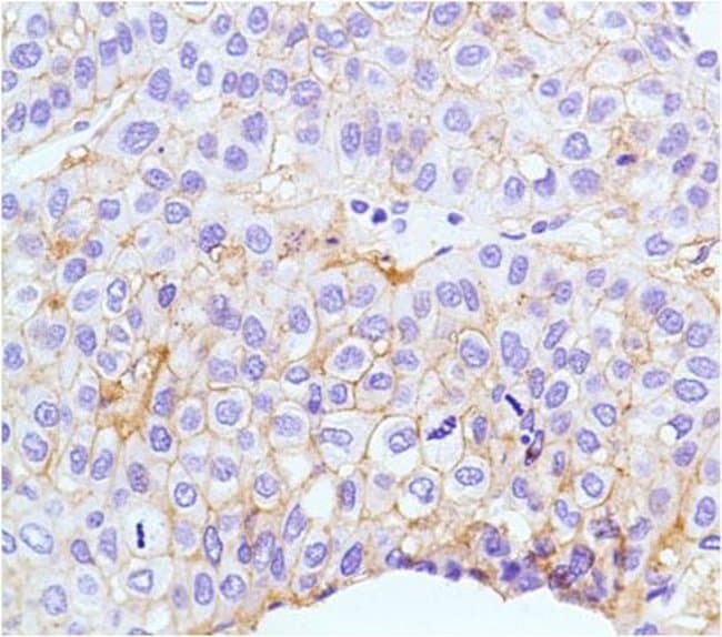 Anti-Claudin-1