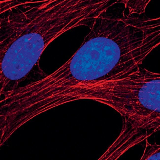 100UL CLEAVED CASPASE-9 (ASP353) .