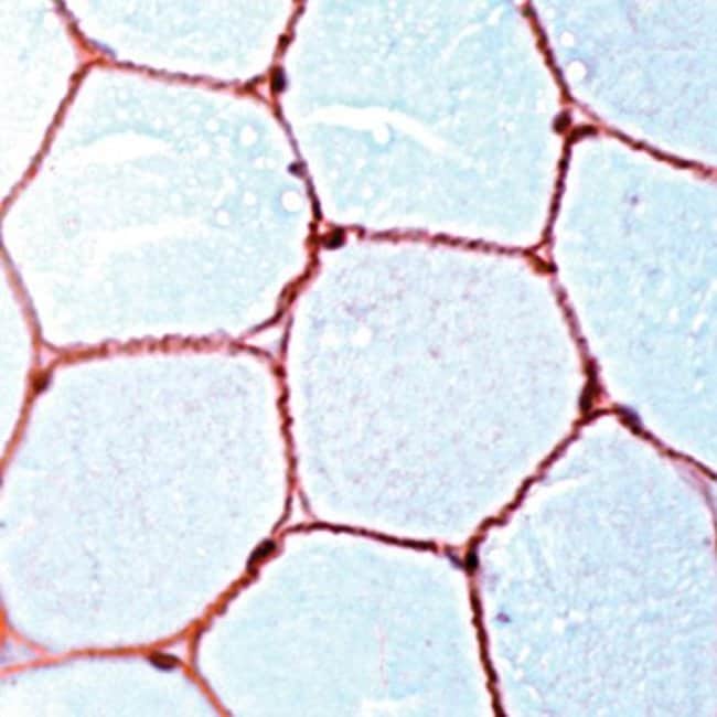 500uL Polyclonal antibody, dystrophin, h