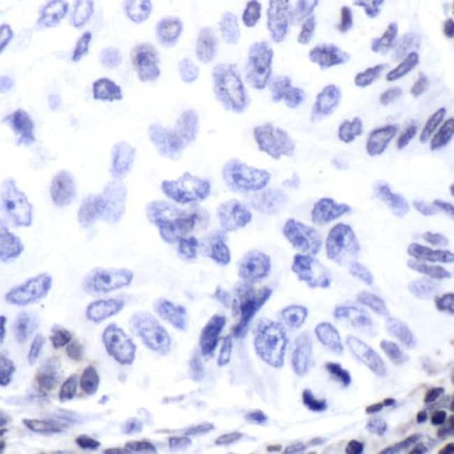 Anti-ERCC1