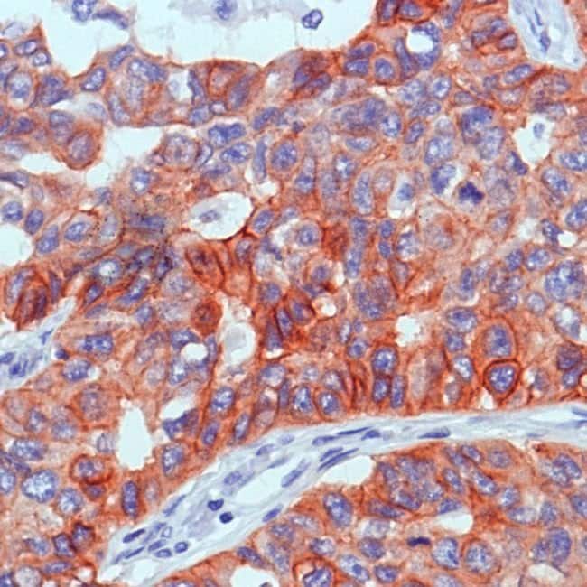 ANTI-EPIDERMAL GROWTH FACTOR RECEPTOR
