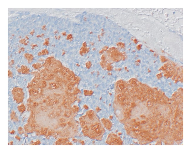 500 UL CALCITONIN (SP17) RABBIT MAB (SUP