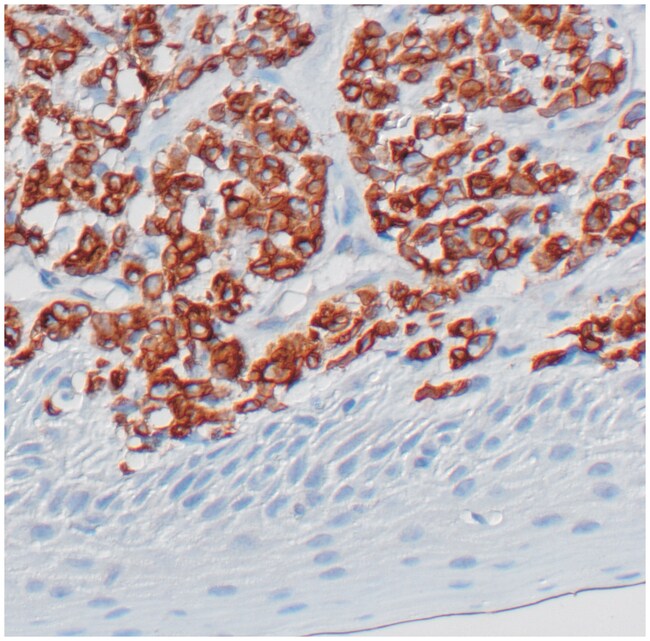 1 ML CD79A / MB-1 (B-CELL MARKER) (SP18)