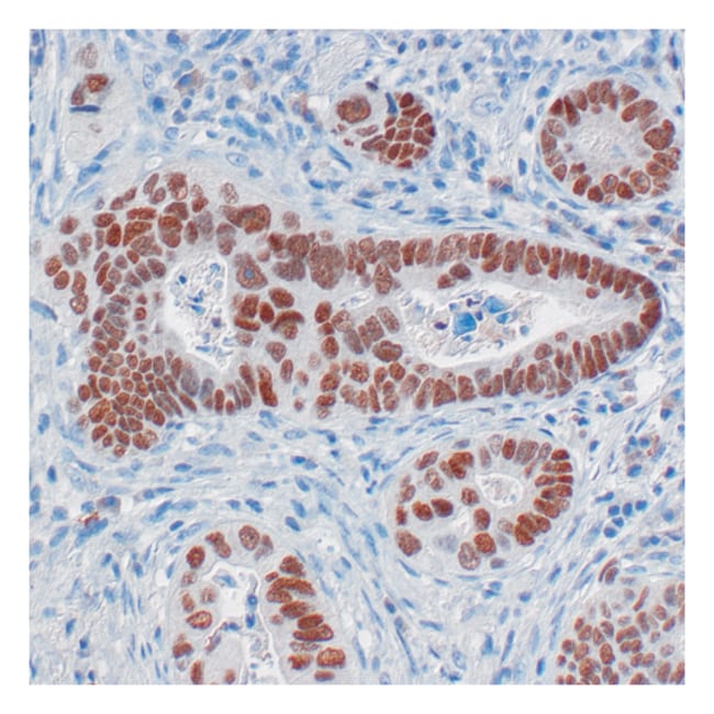 CDX2 [EPR2764Y] 1mL