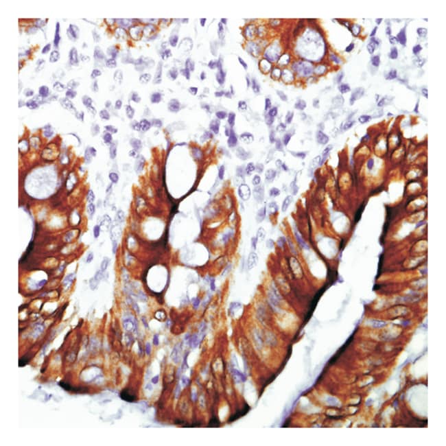 1 ML KERATIN 20 AB-1 MOUSE MAB (SUPERNAT