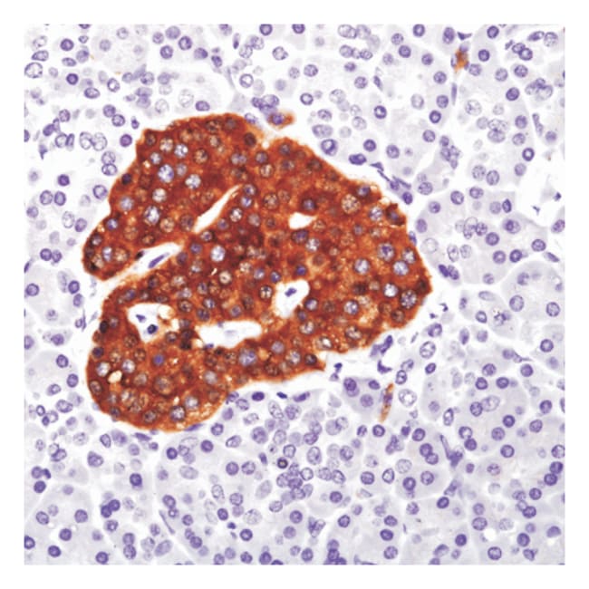 1 ML SYNAPTOPHYSIN (NEUROENDOCRINE MARKE