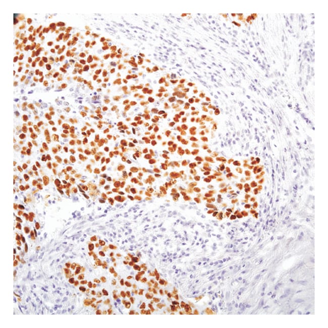 7 ML P53 ( SP5) RABBIT MAB READY-TO-USE