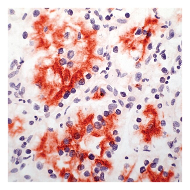 Renal Cell Carc Marker mAb
