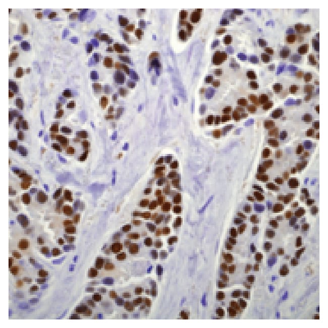 7 ML ESTROGEN RECEPTOR (SP1) RABBIT MAB