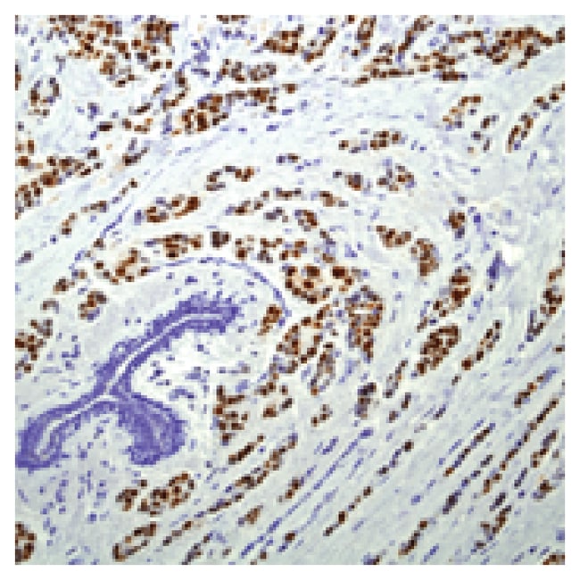 1 ML PROGESTERONE RECEPTOR (SP2) RABBIT