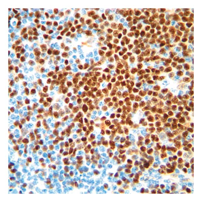 500 UL CYCLIN D1 (SP4) RABBIT MAB (SUPER