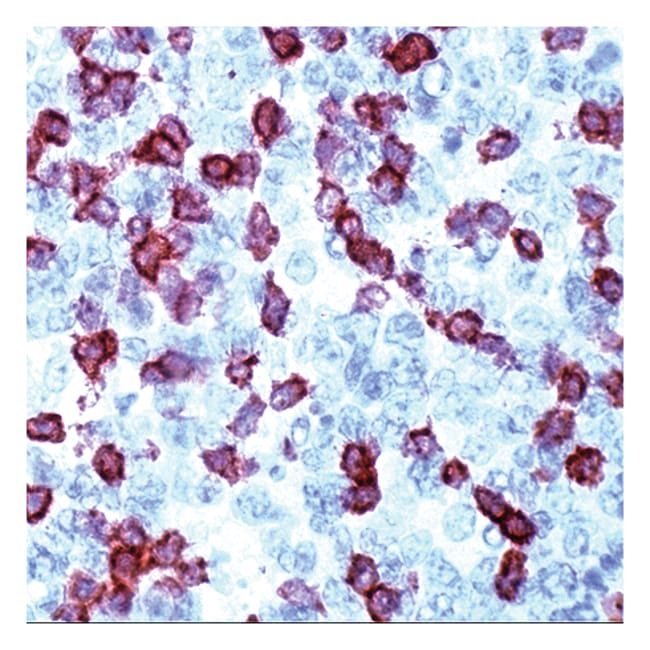 7 ML CD3 (SP7) RABBIT MAB READY-TO-USE F